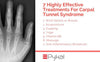7 Highly Effective Non-Surgical Treatments for Carpal Tunnel Syndrome